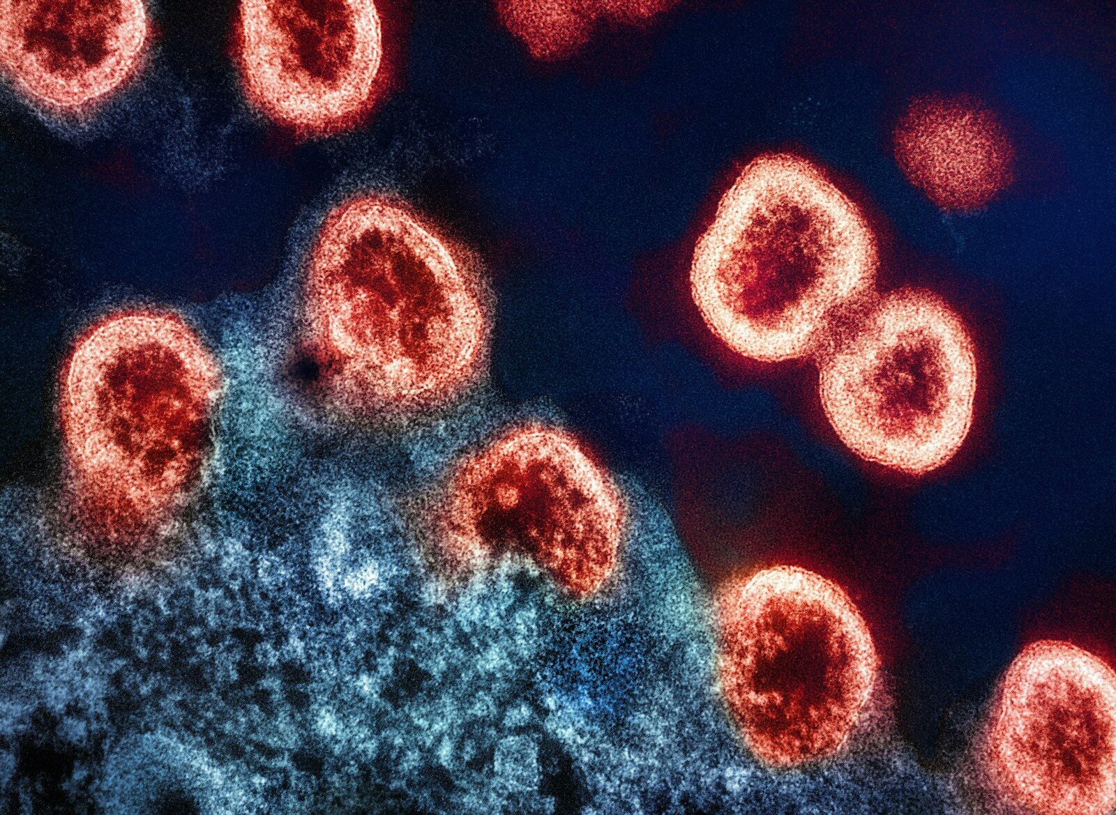 Chronic Infections & Post-Viral Recovery
